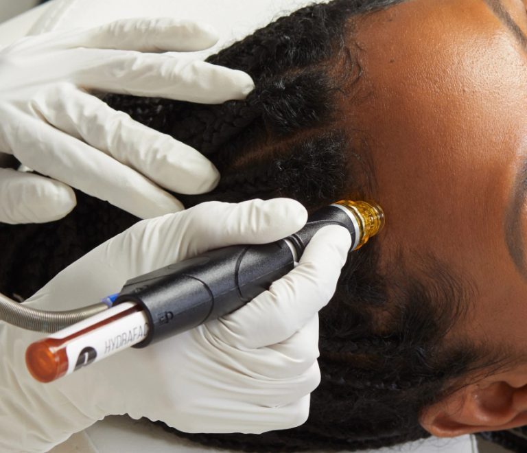 Hydrafacial Hair Scalp