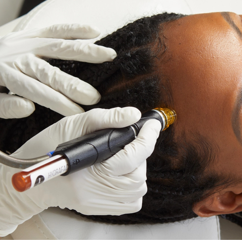 Hydrafacial Hair Scalp